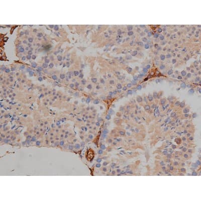MAPT / Tau Antibody (phospho-Ser404)