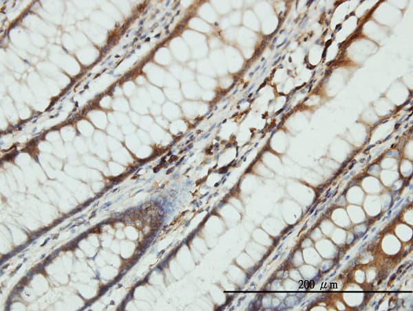 SARS / Serine-tRNA Ligase Antibody (clone 1H4)