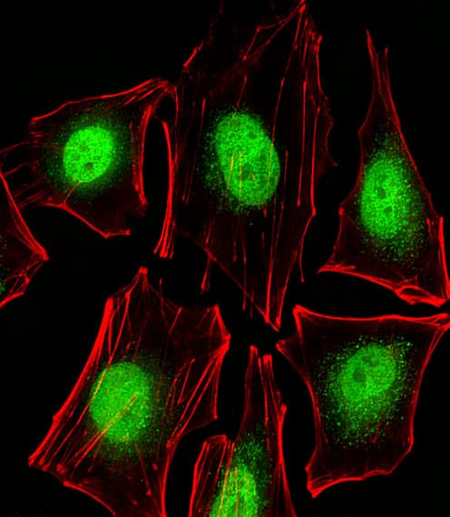 PTK2B / PYK2 Antibody (aa805-838)