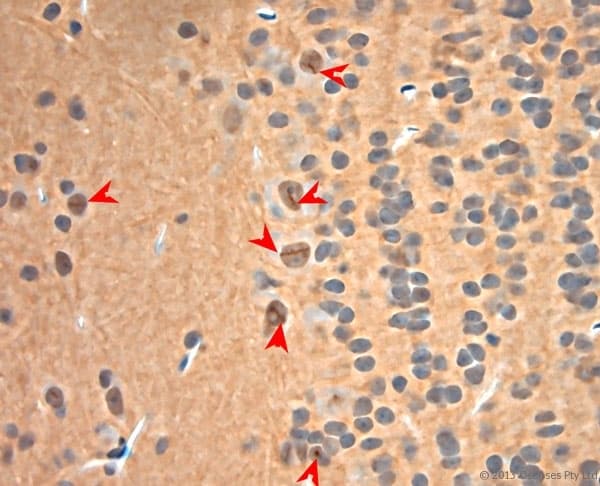 NGF Antibody (aa130-180)