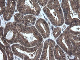 CRYAA / Alpha A Crystallin Antibody (clone OTI3B12, Carrier-free)