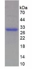 Mouse TNFRSF14 / CD270 / HVEM Protein (Recombinant His)