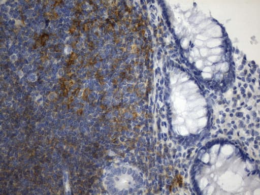 CD40 Antibody (aa21-166, clone UMAB255, Carrier-free)