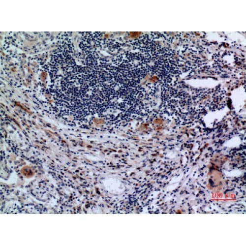 CD71 / Transferrin Receptor Antibody (91-140 aa, N-terminal)