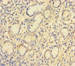 VKORC1L1 Antibody