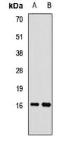 FABP12 Antibody