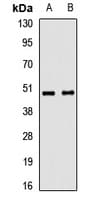 Polyclonal Rabbit anti-Human TRIM44 Antibody (WB)