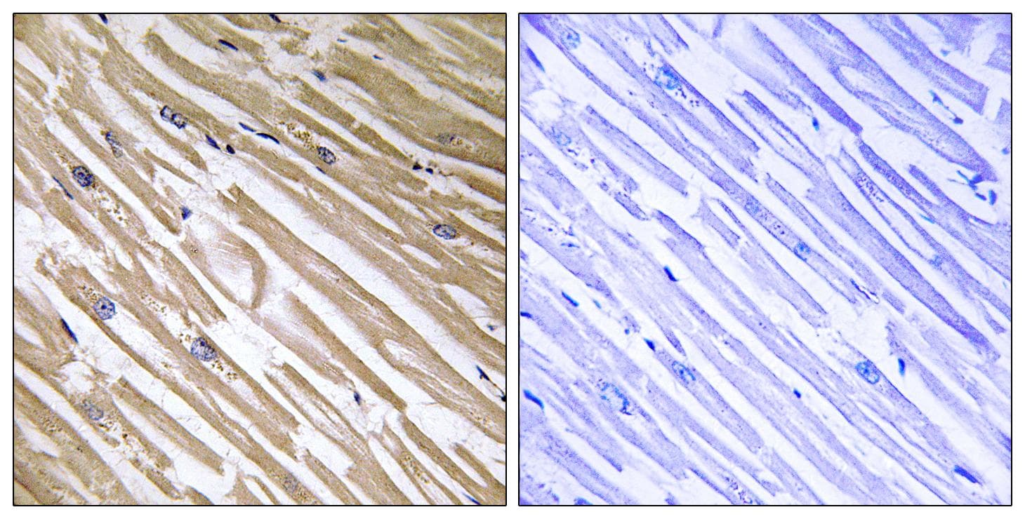 Polyclonal Rabbit anti-Human NDRG4 Antibody (IHC, WB)