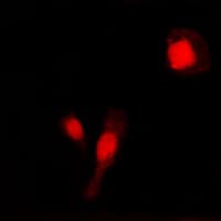 MMP2 Antibody (C-Terminus)