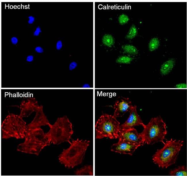 Monoclonal Mouse anti-Human CALR / Calreticulin Antibody (clone 1G6A7, EEEDVPGQAKDELC, IHC, IF, WB)