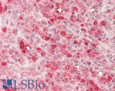 IHC-plus™ Polyclonal Rabbit anti-Human SNX20 Antibody (aa 1-102, IHC, WB)
