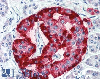 IHC-plus™ Polyclonal Rabbit anti-Human CHGB / Chromogranin B Antibody (IHC, WB)