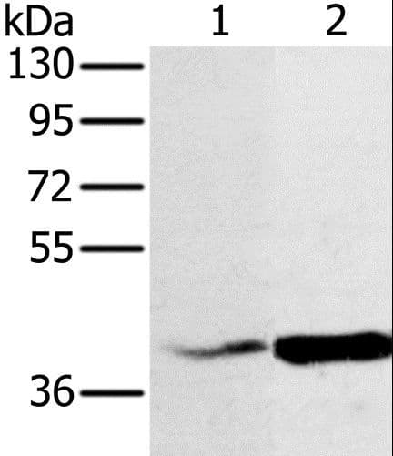 NDUFA10 Antibody