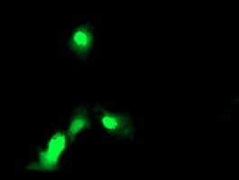 EXOSC7 Antibody (clone OTI2E5)