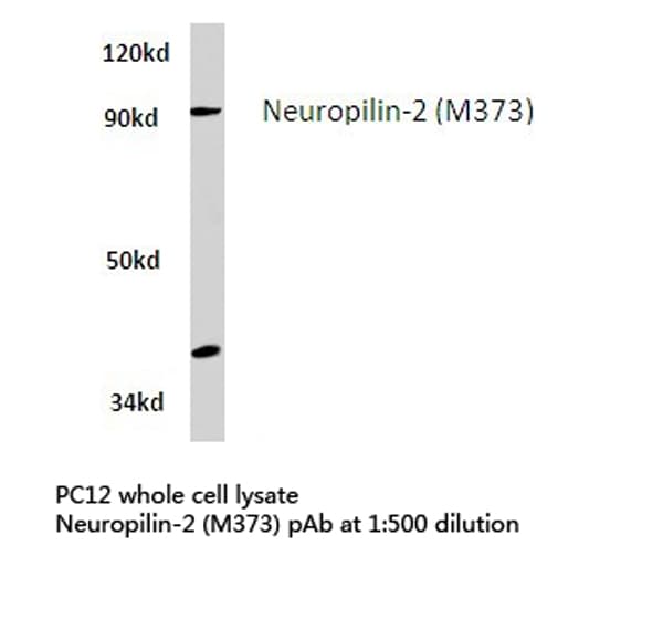 Polyclonal Rabbit anti-Human NRP2 / Neuropilin 2 Antibody (Met373, WB)
