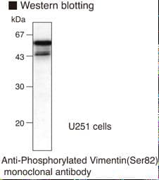 Vimentin Antibody (phospho-Ser82, clone MO82)