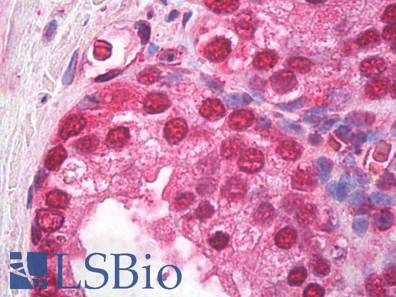 IHC-plus™ HSP40 Antibody