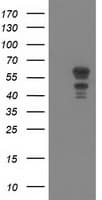 KATNAL1 Antibody (clone OTI4G1)