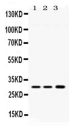 AQP11 / Aquaporin 11 Antibody