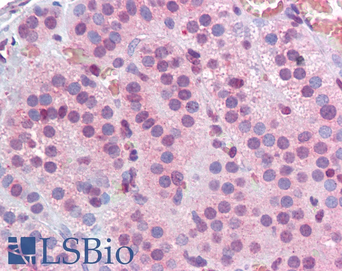 IHC-plus™ MBD2 Antibody (aa15-29)