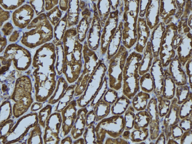 Polyclonal Rabbit anti-Human HLA-DMA Antibody (IHC, WB)