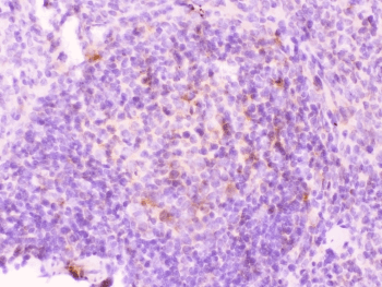 Polyclonal Rabbit anti-Human MMP11 Antibody (IHC, WB)