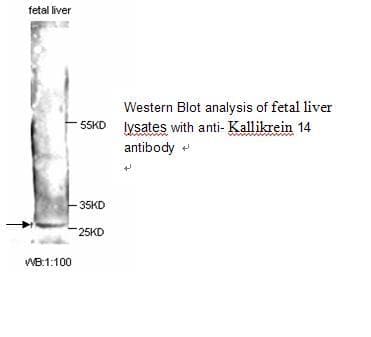 Polyclonal Rabbit anti-Human KLK14 / Kallikrein 14 Antibody (WB)