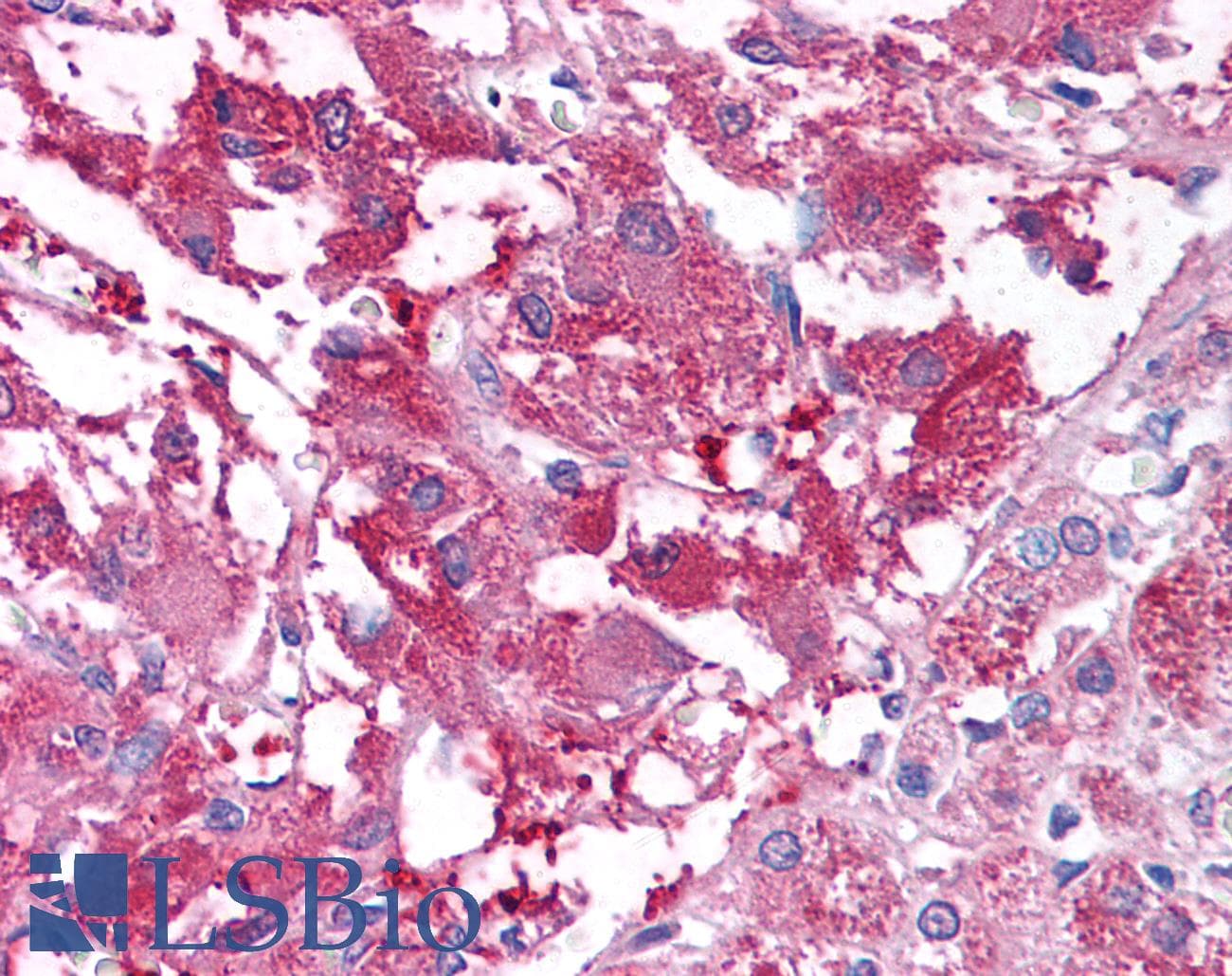 IHC-plus™ USP20 / VDU2 Antibody (Internal)