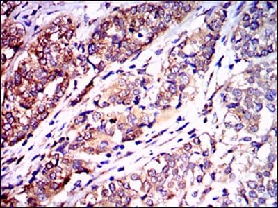 NF-L / NEFL Antibody (clone 1H3)