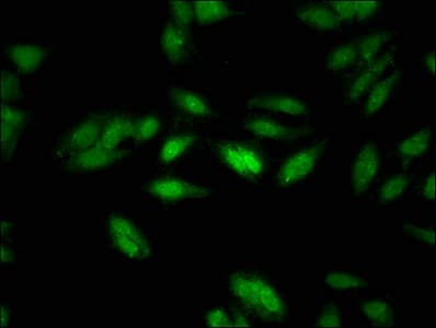 N-CoR / NCOR1 Antibody