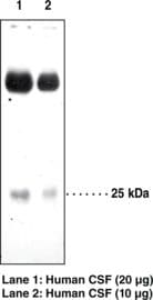 Prostaglandin D Synthase Antibody