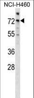 ARAF / ARAF1 / A-RAF Antibody (aa249-277)