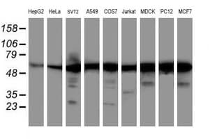 AKT1 Antibody (clone OTI4C11)