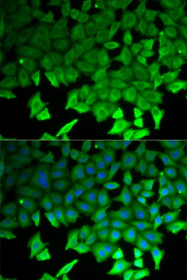Polyclonal Rabbit anti-Human LITAF Antibody (IHC, IF, WB)