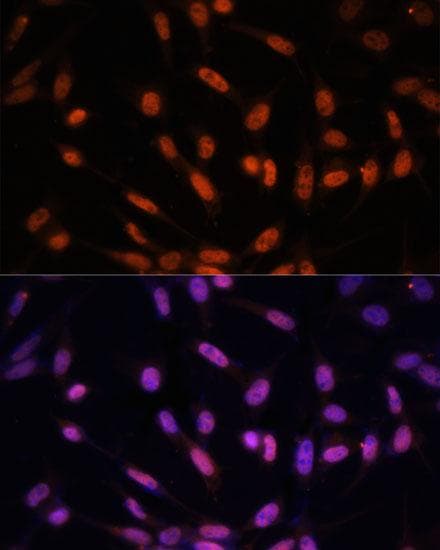 TWIST1 / TWIST Antibody