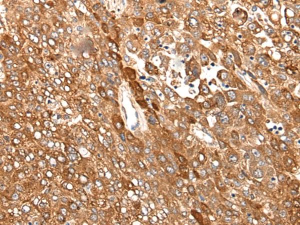 CAD Antibody
