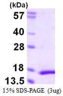 Human MFSD7 / MYL5 Protein (Recombinant His)