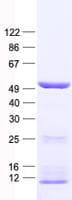 Human KRT20 / CK20 / Cytokeratin 20 Protein (Recombinant His, N-Terminal)