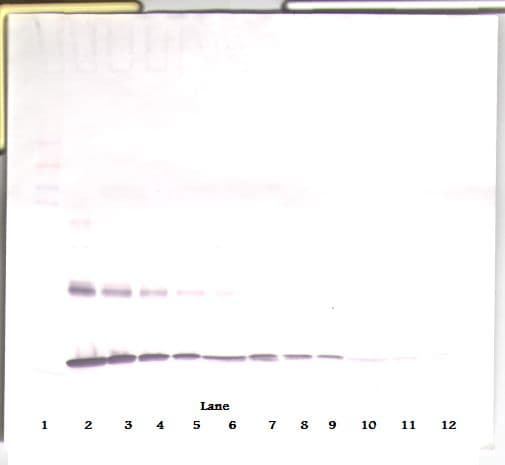IL1A / IL-1 Alpha Antibody
