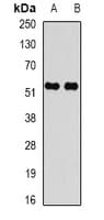 CARD8 / Cardinal / TUCAN Antibody