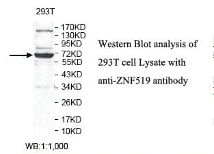 ZNF519 Antibody (aa249-532)