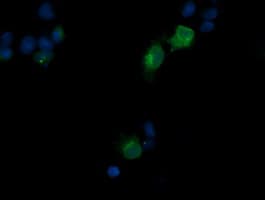 CD1C Antibody (clone OTI1F4)