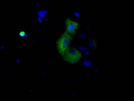 Monoclonal Mouse anti-Human BTK Antibody (clone OTI3D11, IHC, IF, WB)