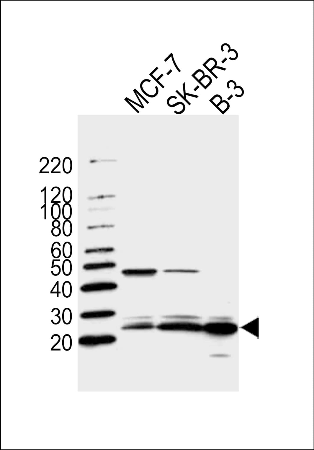 FAM216B Antibody (aa106-139)