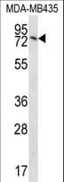 UNC84B / SUN2 Antibody (aa237-265)