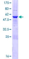 Human MTX2 Protein (Recombinant GST)