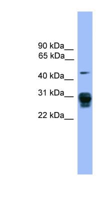 PSMD9 / 26S Proteasome Antibody (aa71-120)