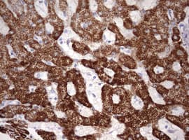 OTC Antibody (aa33-354, clone OTI7B1)