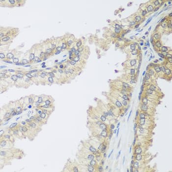 IGFBP4 Antibody