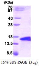 Human BMP5 Protein (Recombinant)